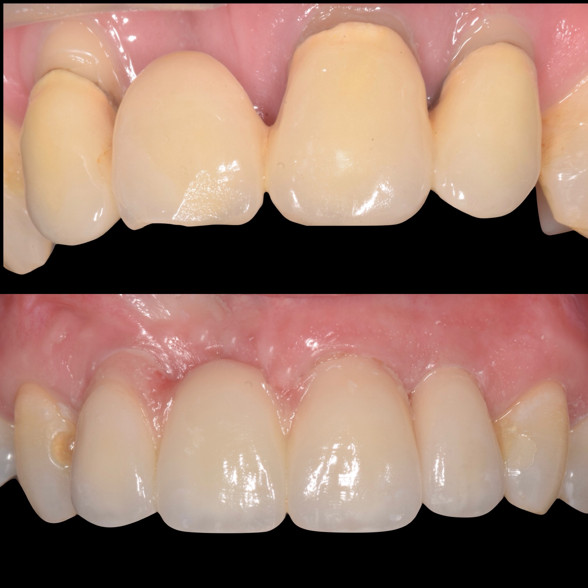 Alsager Dentist – Lawton Dental Care – General & Cosmetic Dentist Alsager
