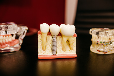 Alsager Dentist – Lawton Dental Care – General & Cosmetic Dentist Alsager